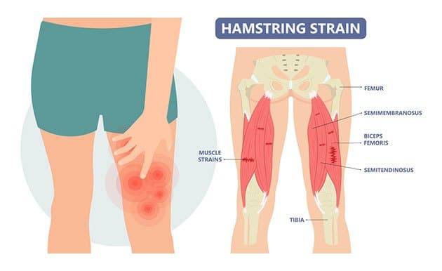 common lacrosse shoulder injuries